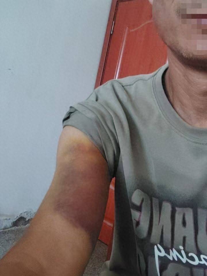 皇冠信用网怎么弄_河南一男子称因发视频反映村干部家占道遭殴打 多方回应